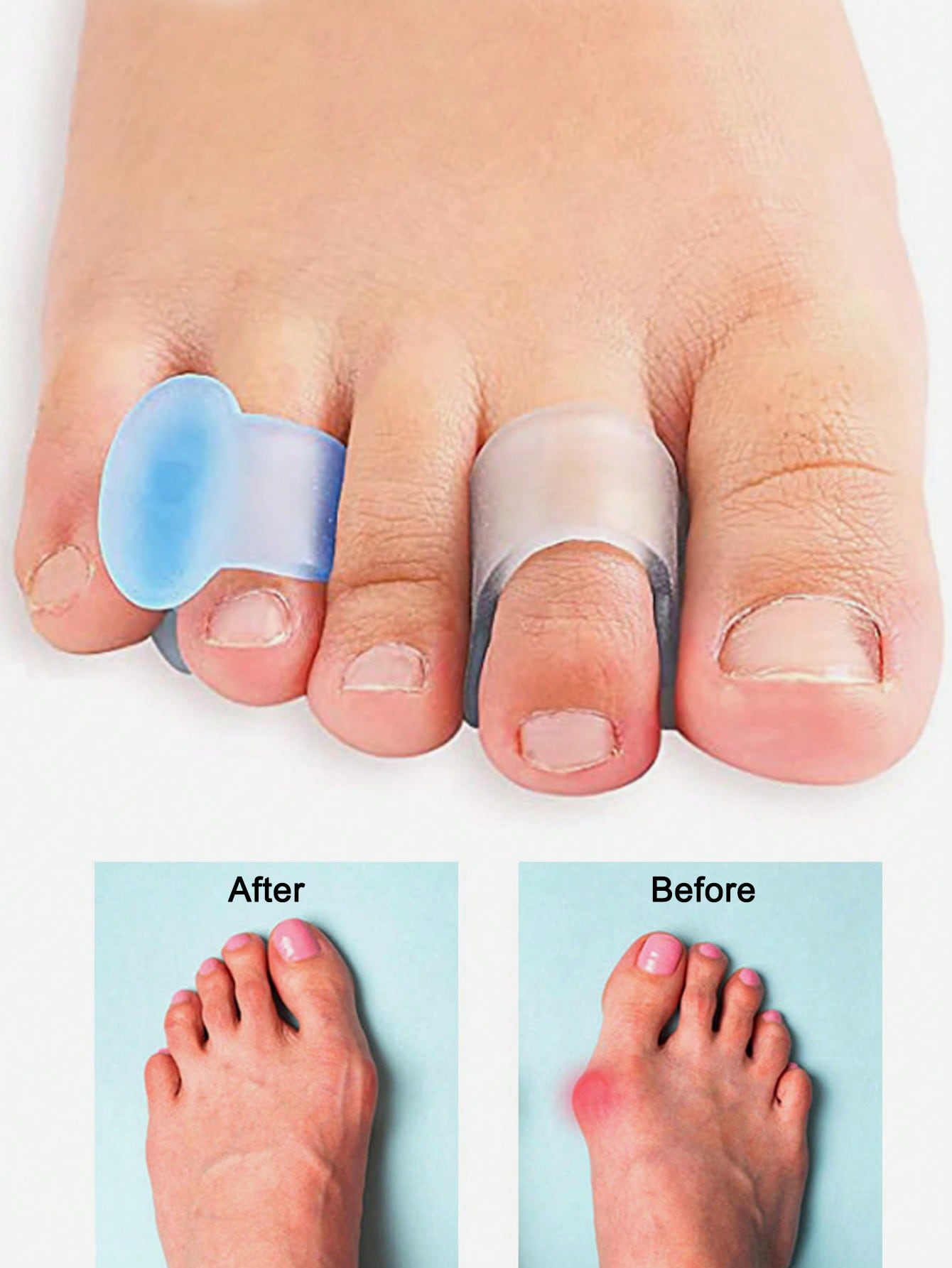 Gel-Zehentrenner, 4 Stück Sili – Yoga Toe Separator Bewertung und Preis